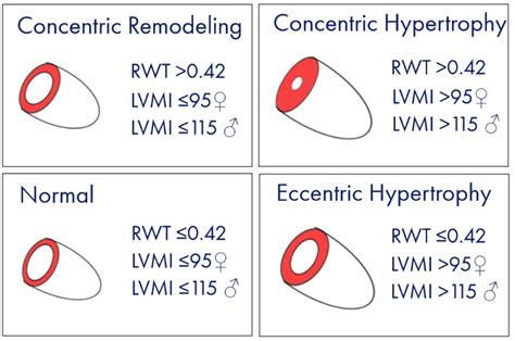 rwt calculator